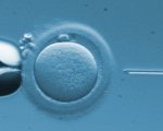 Microiniezione di Spermatozoi - ICSI
