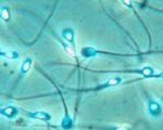 Decondensazione della cromatina spermatica
