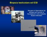 Biopsia icsi